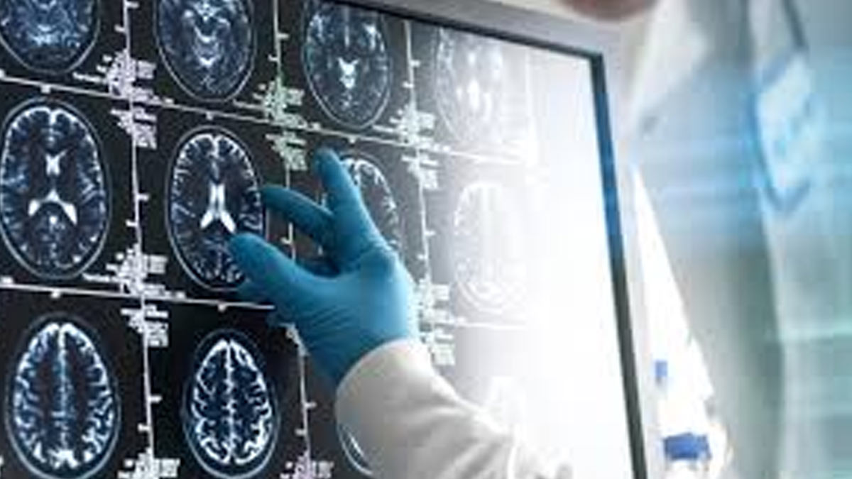 Cancer Cases And Deaths In Men Predicted To Increase By 93% By 2050: Study